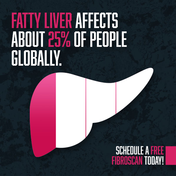 fatty liver fibroscan