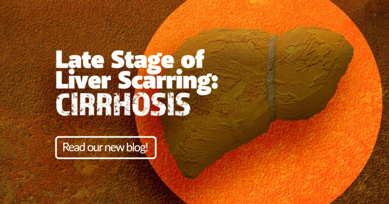 Late stage of liver scarring: cirrhosis