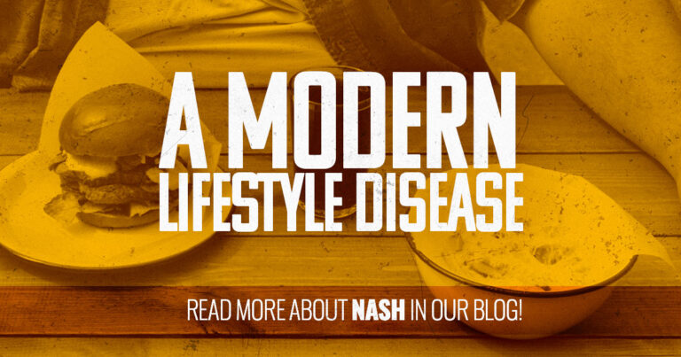 NASH a modern lifestyle disease